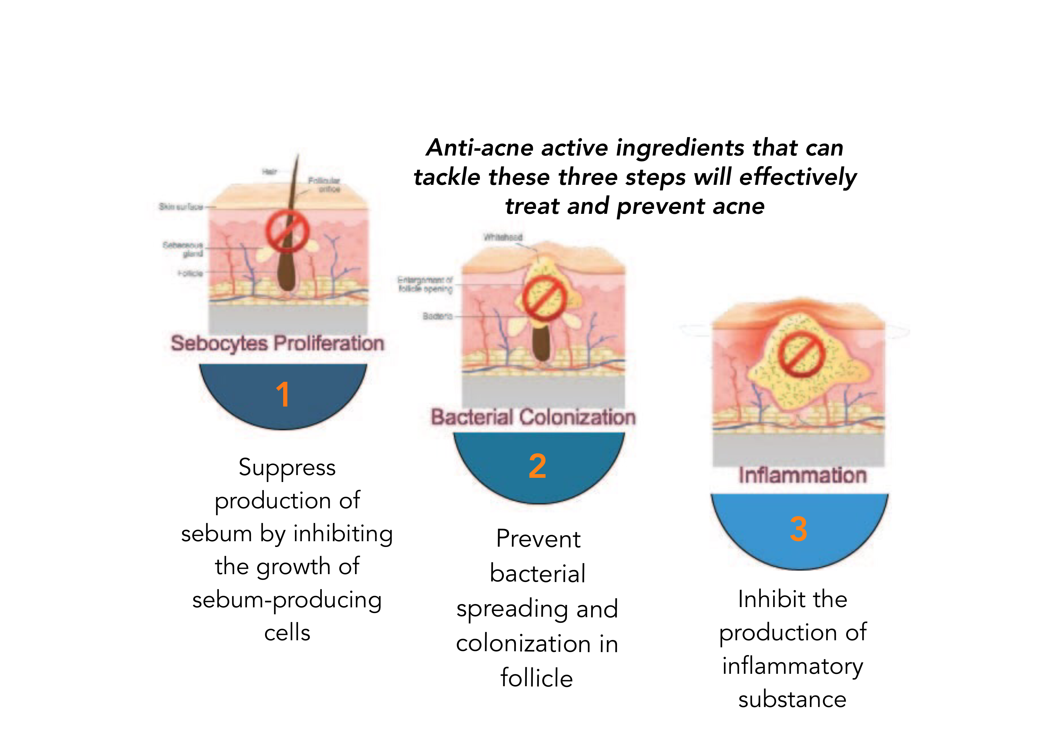 Acne Treatment and Prevention